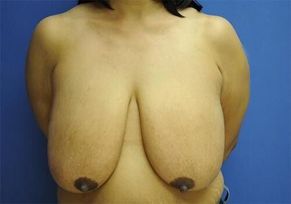 巨乳