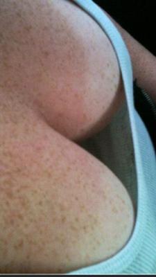 tetas pecosas