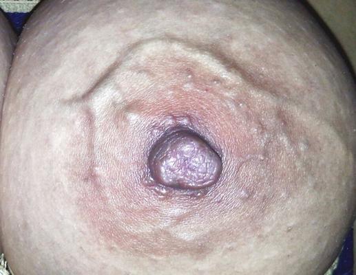 GRANDES TETAS Y PEZONES