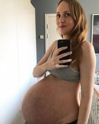Niñas embarazadas que llevan mi ADN