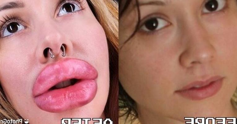 Avant et Après (Bimbos)