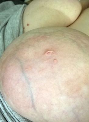 gros seins grosses