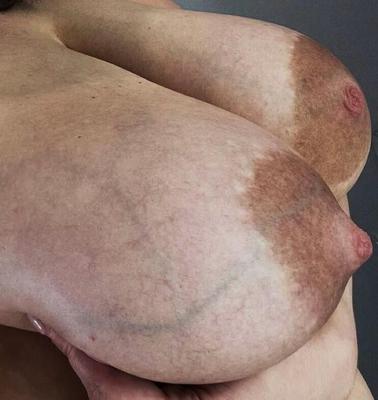 テクスチャ付き乳輪