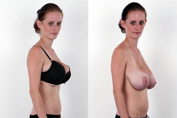 Dressed Undressed