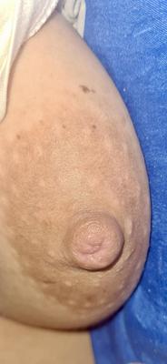 Mamilos