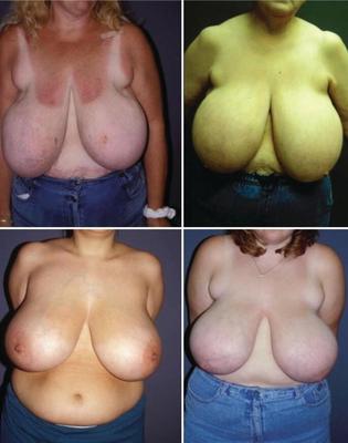 Big Titts collage