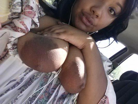 Areolas oscuras